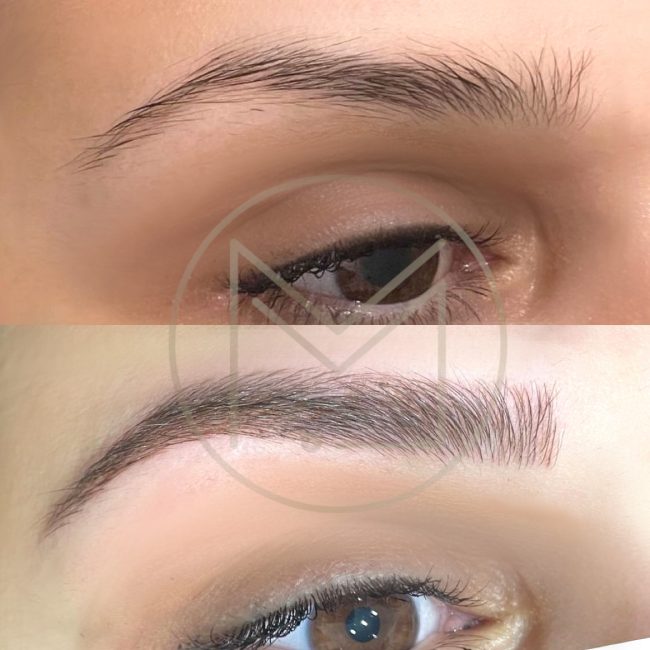Microblading