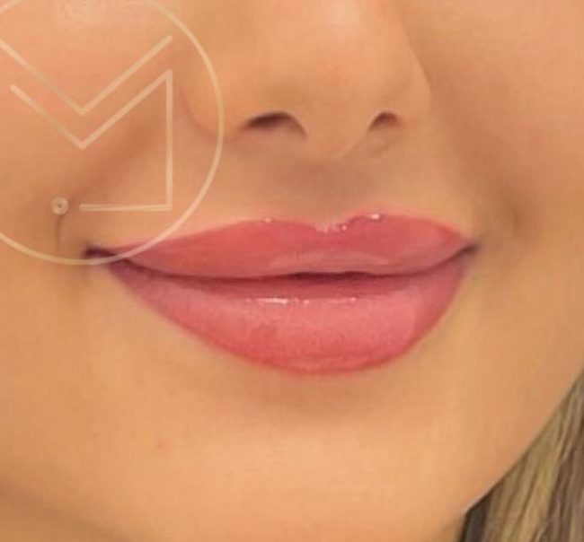 Lippen Permanent Make-up